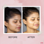 Before after Tomato Face Wash with Purifying Gram Flour