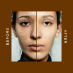 Before & after image Retinol Serum